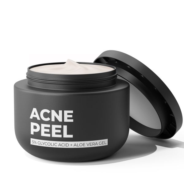 Acne Peel
